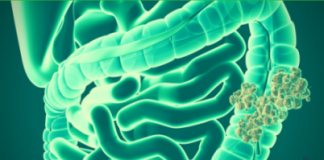 warning symptoms of colon cancer