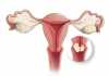 10 Early Warning Signs for Cervical Cancer You Shouldn’t Ignore cervical cancer warning signs