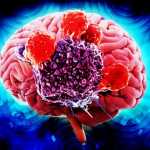 symptoms of Brain Cancer