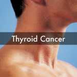 Thyroid Cancer signs