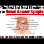 Bowel Cancer Symptoms