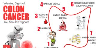 Symptoms of Colon Cancer