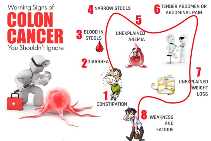 Symptoms of Colon Cancer