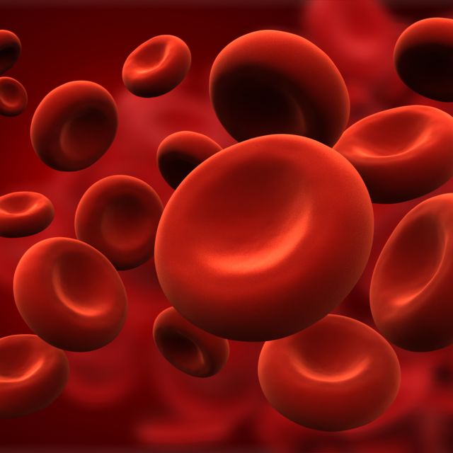 anemia