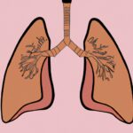 2 lungs with a disease in them