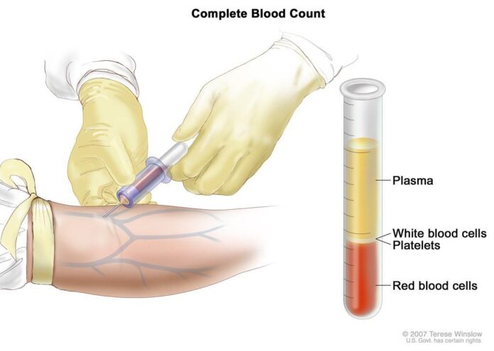 New Blood Test Offers Early Detection of Bone Cancer