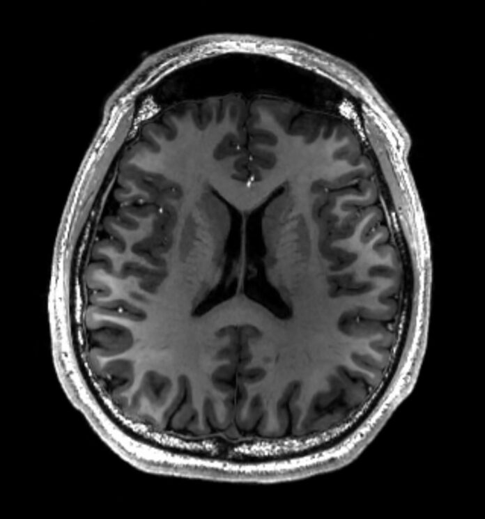 How Effective is MRI in Detecting Bone Cancer?