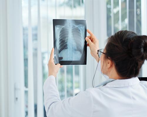 The Top 5 Causes of Lung Cancer: What You Need to Know