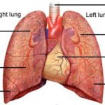 The Dangers of Lung Cancer Fluid Buildup: Understanding Pleural Effusion