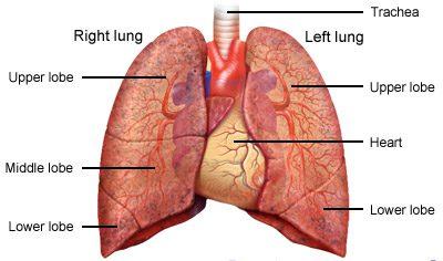 The Dangers of Lung Cancer Fluid Buildup: Understanding Pleural Effusion