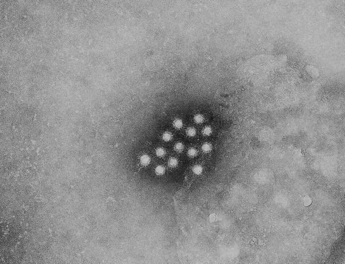 10-symptoms-of-hepatitis-a-you-should-never-ignore.jpg 10 Symptoms of hepatitis A You Should Never Ignore