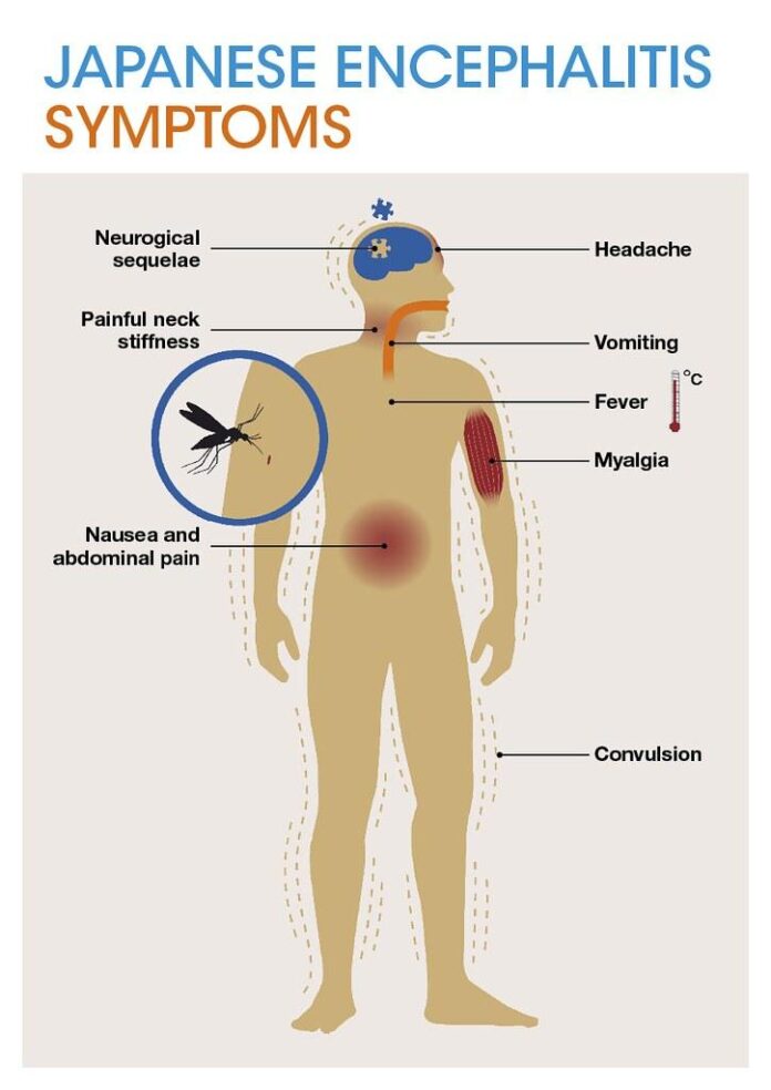 10 Symptoms of cholera You Should Never Ignore