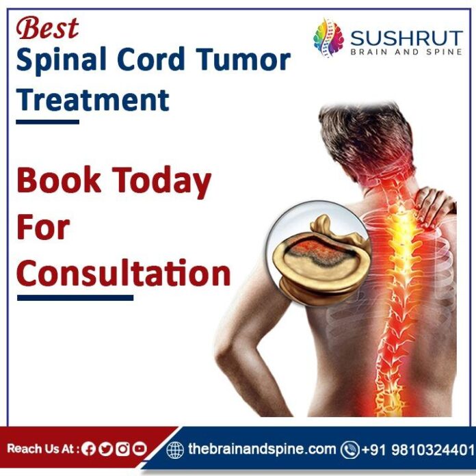 10-symptoms-of-spinal-cord-tumor-you-should-never-ignore.jpg 10 Symptoms of spinal cord tumor You Should Never Ignore