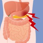 10 Symptoms of mesenteric ischemia You Should Never Ignore