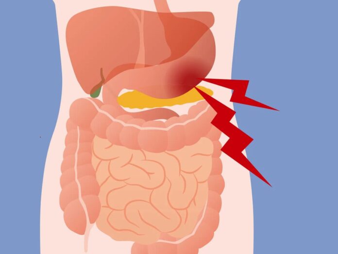 10 Symptoms of mesenteric ischemia You Should Never Ignore