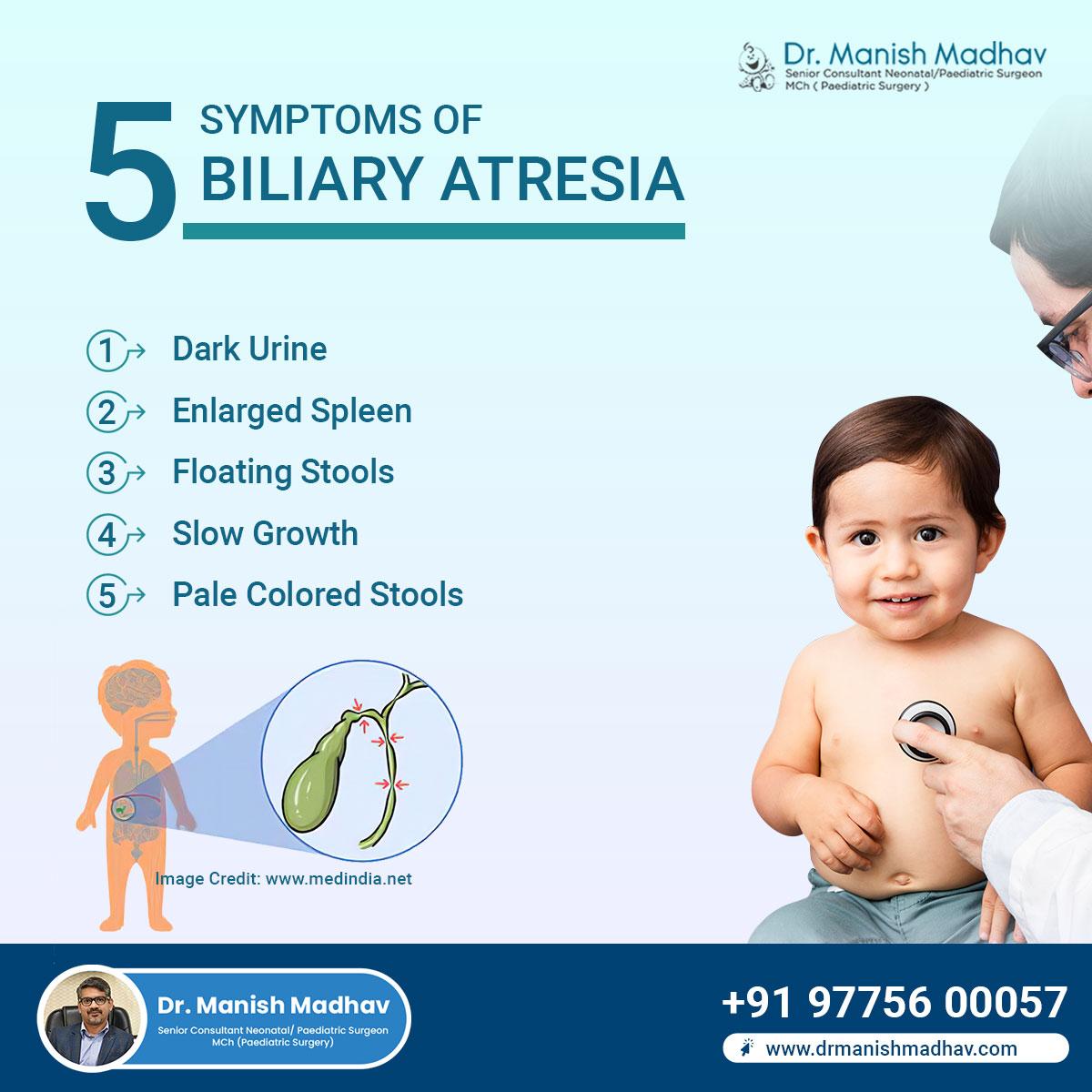 10 Symptoms of biliary atresia You Should Never Ignore