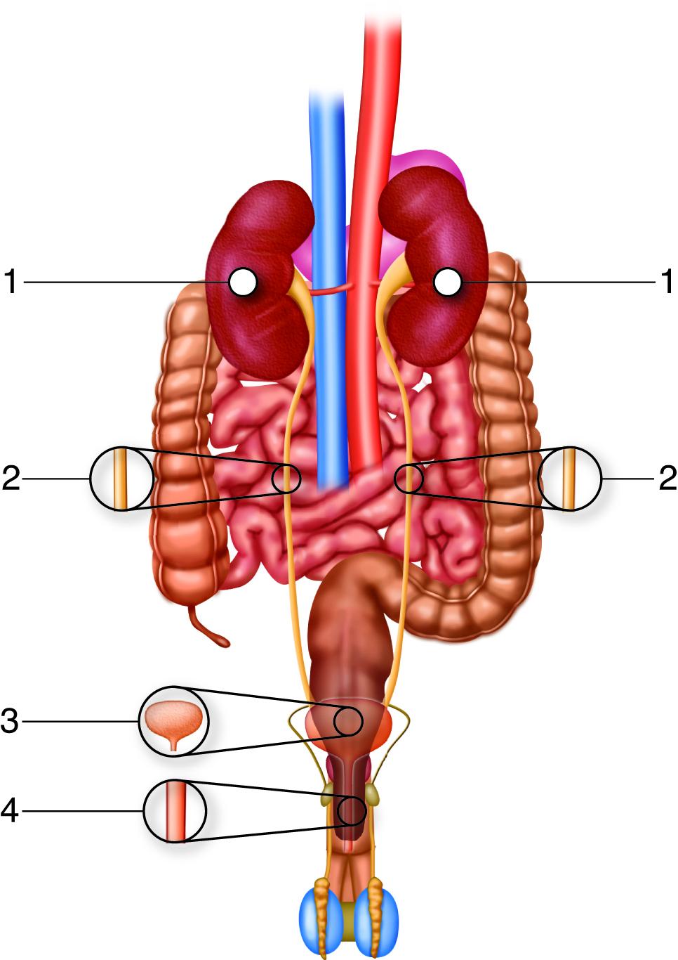 10 Symptoms of renal artery stenosis You Should Never Ignore