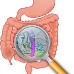 Understanding the Common Causes of Gastrointestinal Diseases