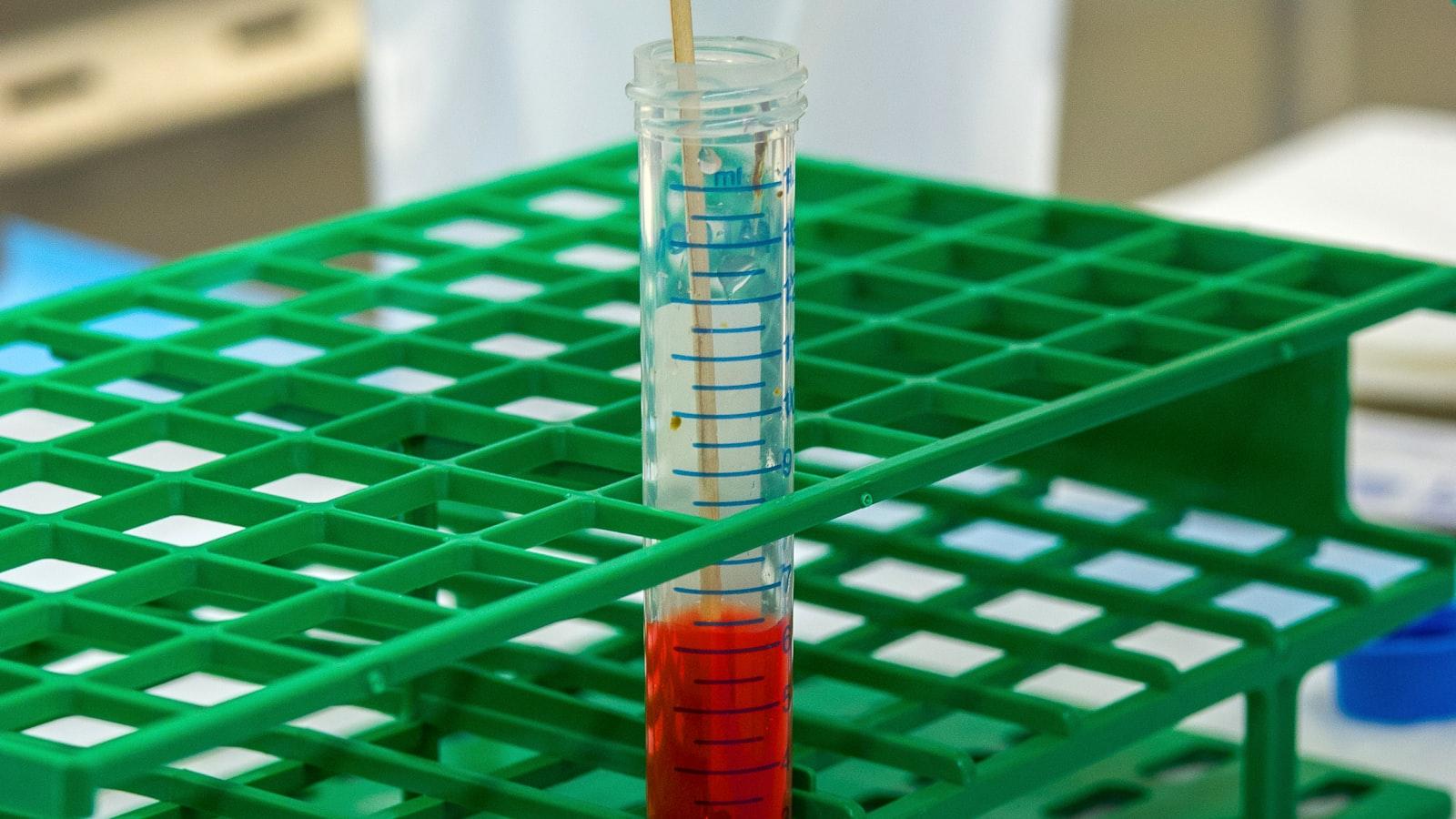 The Ultimate Guide to Onetouch Ultra Test Strips: A Must-Have for Diabetics