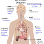 Understanding Diabetic Eye Disease: Symptoms, Treatments, and Prevention