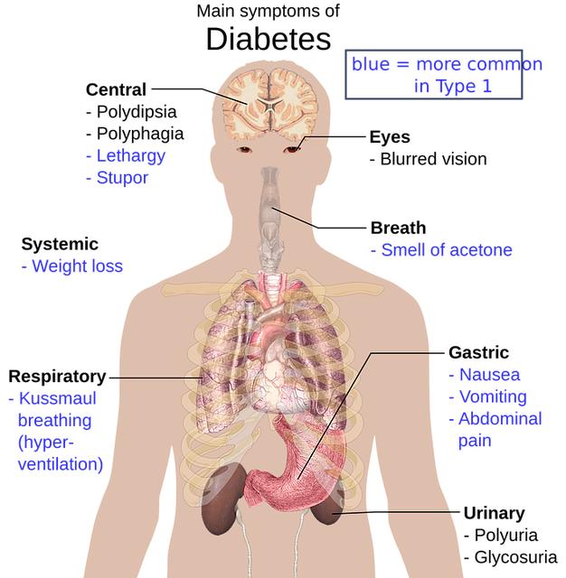 Understanding Diabetic Eye Disease: Symptoms, Treatments, and Prevention