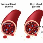 Understanding the Importance of the A1C Blood Test in Diabetes Management