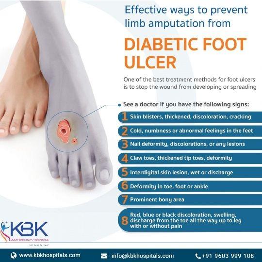 New Breakthrough in Diabetic Foot Ulcer Treatment