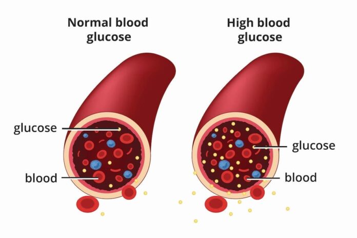 The Diabetic 10-Step Plan for Successful Weight Loss